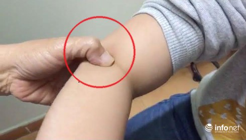 Cách trị ho không cần dùng thuốc kháng sinh - ảnh 1