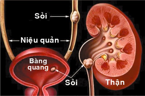 Hai thói quen cực kỳ nguy hiểm có thể làm mất thận - ảnh 1