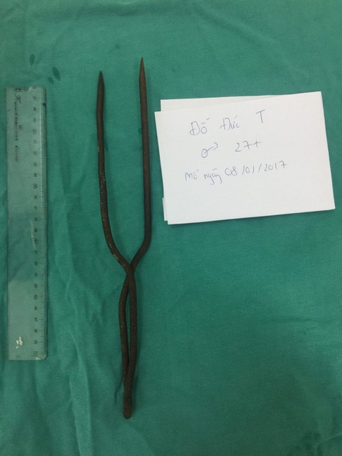 Nín thở cứu thanh niên bị thanh sắt hai đầu nhọn đâm xuyên tim - ảnh 1