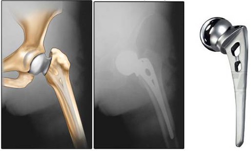 Đau khớp gối về đêm, cảnh báo bệnh nguy hiểm gây tàn phế - ảnh 1