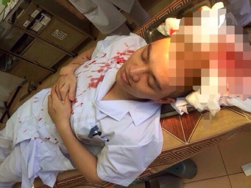Cháu bé trong vụ bố bệnh nhi đánh bác sĩ Bệnh viện đa khoa Thạch Thất ra viện - ảnh 1