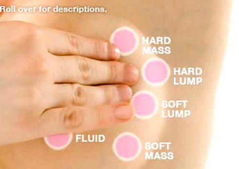 Ngứa ở ngực là dấu hiệu của u xơ tuyến vú? - ảnh 1