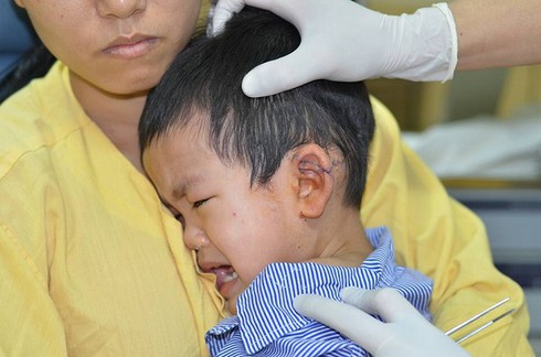 Bé 3 tuổi bị xe chở tôn cứa đứt tai - ảnh 1