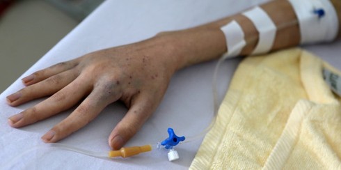 Bất cứ ai cũng phải nhớ 9 dấu hiệu này của bệnh ung thư - ảnh 2