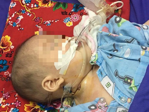 SOS: Hãy dừng ngay cho trẻ uống thuốc cam không rõ nguồn gốc - ảnh 1