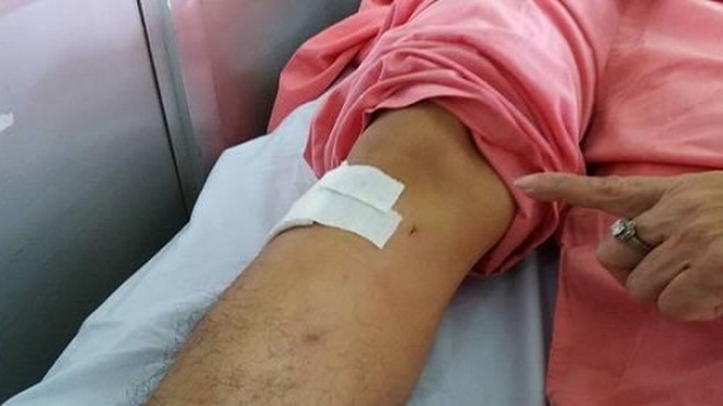 Sự cố khoan nhầm xương chân bệnh nhân: Bệnh viện Chợ Rẫy thừa nhận có nhầm lẫn