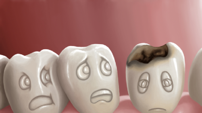 Điểm mặt các bệnh răng miệng thường gặp