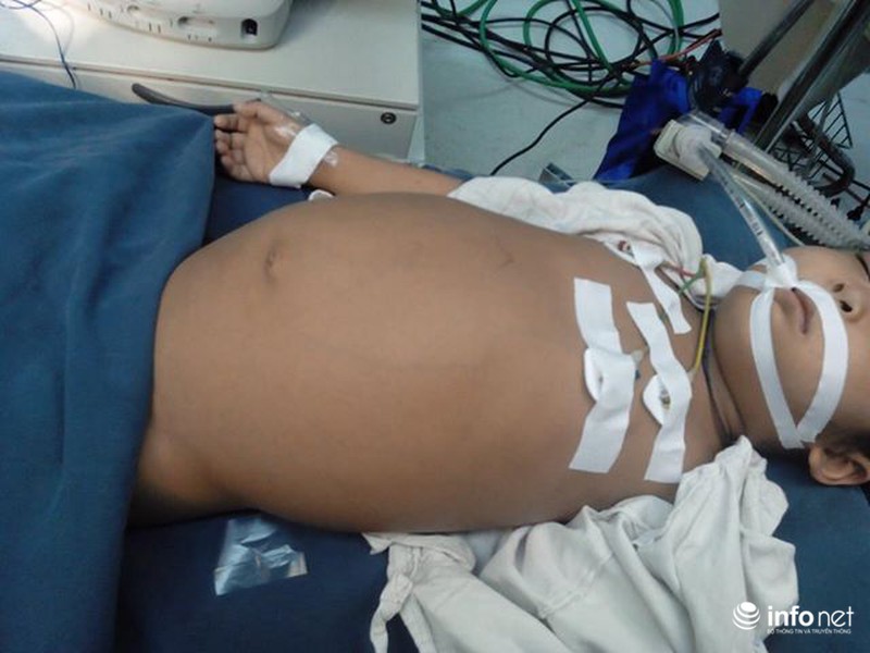 Hành trình chữa bệnh của bé gái người Lào tại Việt Nam - ảnh 1