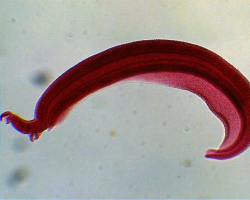 Sán làm tổ trong bụng, hai anh em cứ ngỡ bị ung thư - ảnh 1