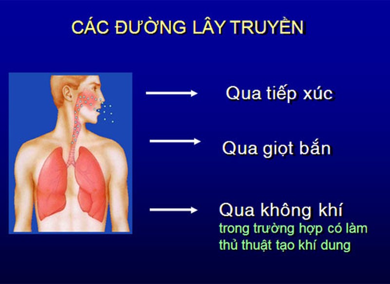 Phòng dịch Mers – CoV: Thêm một bệnh nhân được xét nghiệm âm tính - ảnh 1