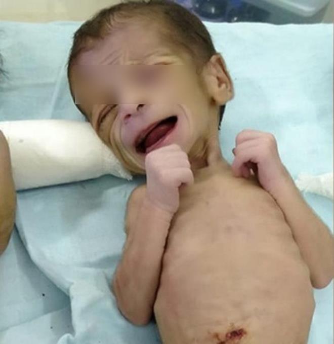 Bị bỏ rơi ở nghĩa địa, vườn hoang, nhiều bé sơ sinh sống sót kỳ diệu - 3