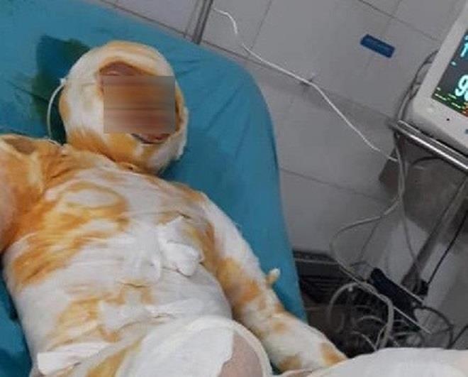 Khởi tố kẻ tưới xăng đốt vợ ở Thái Bình - 1