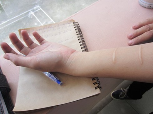 Đắng cay nghề “hot