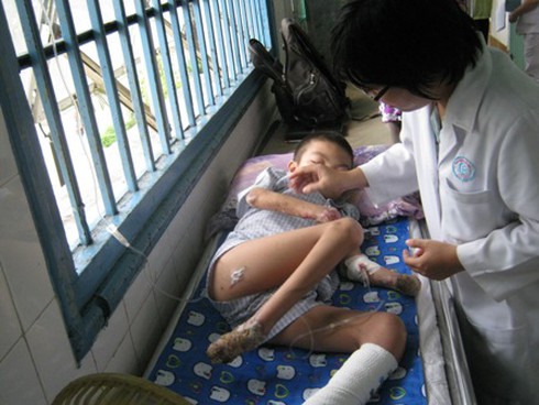 TP.HCM: Xuất hiện bệnh lạ rụng hết tứ chi - ảnh 1