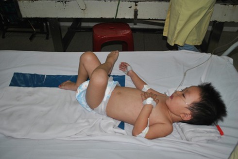 TP.HCM: Nhiều ca sởi đặc biệt, tiêm 2 mũi vắc xin vẫn phát bệnh - ảnh 3