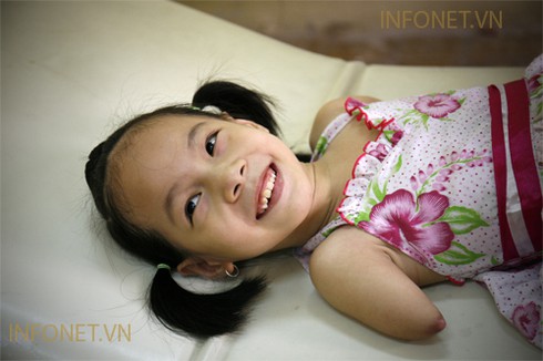 Cuộc sống nghị lực của cháu bé không tay chân - ảnh 11