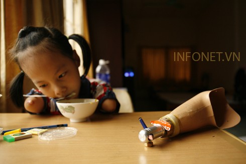 Cuộc sống nghị lực của cháu bé không tay chân - ảnh 13