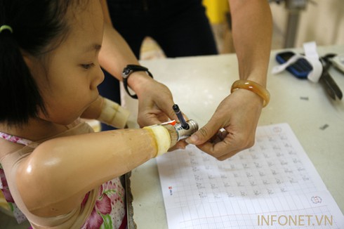 Cuộc sống nghị lực của cháu bé không tay chân - ảnh 1