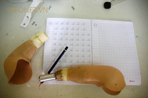 Cuộc sống nghị lực của cháu bé không tay chân - ảnh 4