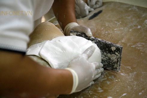 Cuộc sống nghị lực của cháu bé không tay chân - ảnh 9