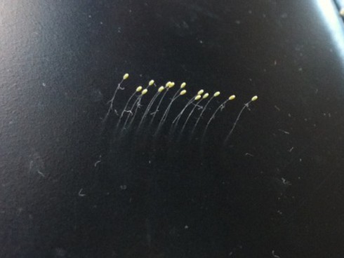 2 lần liên tiếp phát hiện