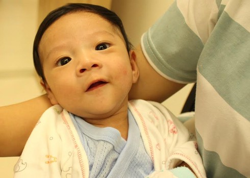 Cứu sống bệnh nhi sơ sinh mắc nhiều dị tật tim bẩm sinh nặng - ảnh 1