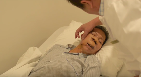 ‘Phép màu’ trả lại gương mặt cho người 10 năm bị ung thư da - ảnh 3