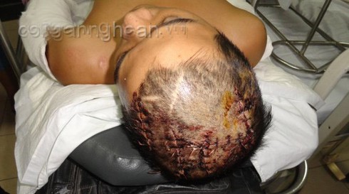 Dùng dao, kiếm chém xối xả vào đầu nạn nhân - ảnh 1