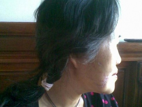 Hải Phòng: Một phụ nữ bị chó cắn nát mặt, rách chân - ảnh 2