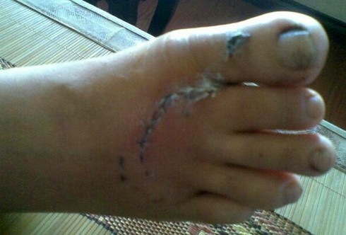 Hải Phòng: Một phụ nữ bị chó cắn nát mặt, rách chân - ảnh 1