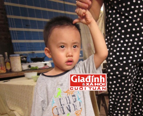 Cháu bé bị đóng kim khâu ngập đầu bây giờ ra sao? - ảnh 2