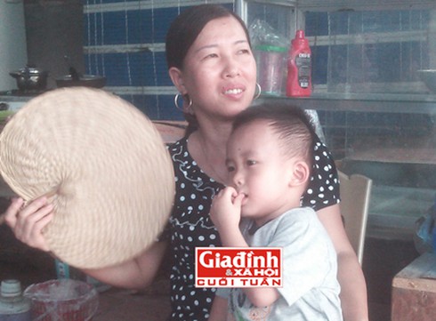 Cháu bé bị đóng kim khâu ngập đầu bây giờ ra sao? - ảnh 1