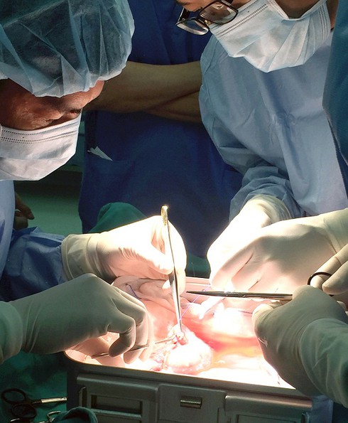 Vinmec Times City: Lần đầu tiên ghép thận thành công cho người nước ngoài - ảnh 2