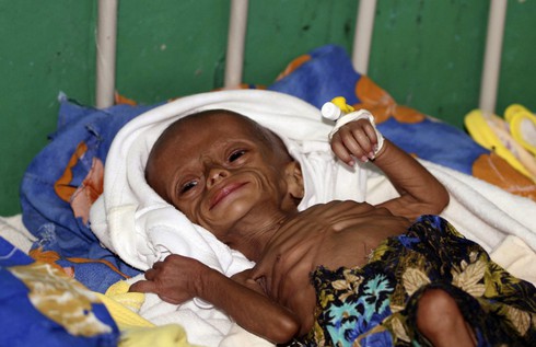 Cận cảnh nơi có cuộc sống tồi tệ nhất thế giới - ảnh 1