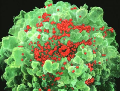 Chấn động: Vaccine AIDS cứu 5 bệnh nhân ‘sạch’ HIV trong 7 tháng - ảnh 1