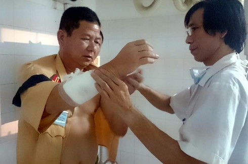 Trung tá CSGT bị gã say rượu ném gạch gãy tay - ảnh 2
