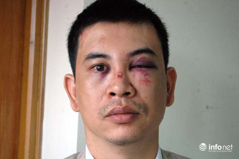 Lời kể của luật sư bị nhóm đối tượng bịt mặt đánh, nhập viện - ảnh 2