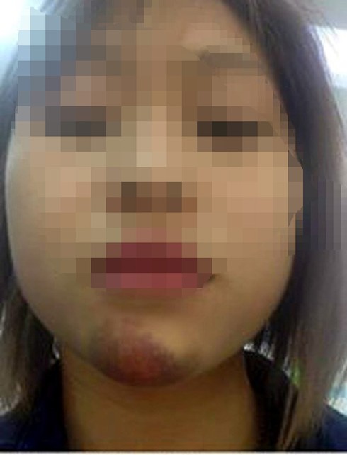 Nữ khách đi xe bus “tố” phụ xe sàm sỡ, đánh tím mặt - ảnh 2