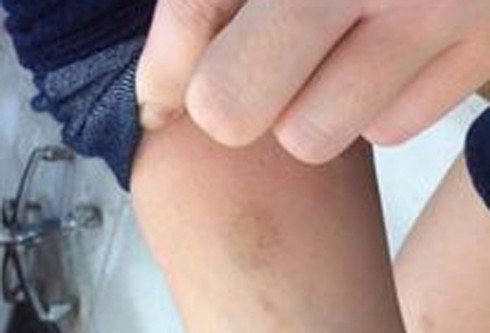 Nữ khách đi xe bus “tố” phụ xe sàm sỡ, đánh tím mặt - ảnh 4