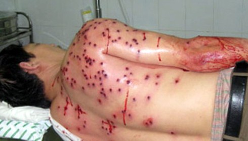 Kẻ dùng súng bắn đạn hoa cải bắn người đã ra đầu thú - ảnh 1