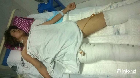 Nữ nạn nhân vụ sập nhà số 43 Cửa Bắc có nguy cơ phải cắt chân - ảnh 2