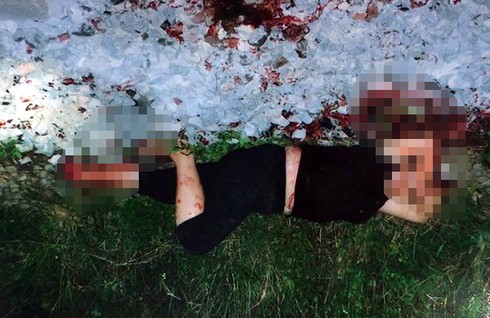 Người thuê chặt chân, tay mình để chiếm 3,5 tỷ bảo hiểm không bị khởi tố - ảnh 2