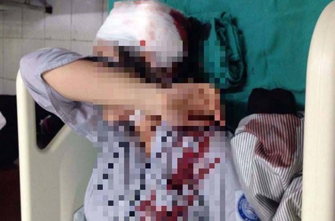 Công an xác minh vụ nữ sinh bị bạn đánh vỡ đầu - ảnh 1