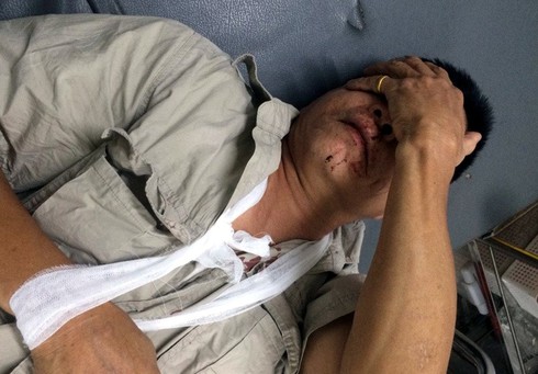 Một cụ ông bị nhóm thanh niên truy sát phải nhập viện trong đêm - ảnh 1