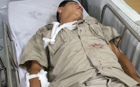 Một cụ ông bị nhóm thanh niên truy sát phải nhập viện trong đêm - ảnh 2