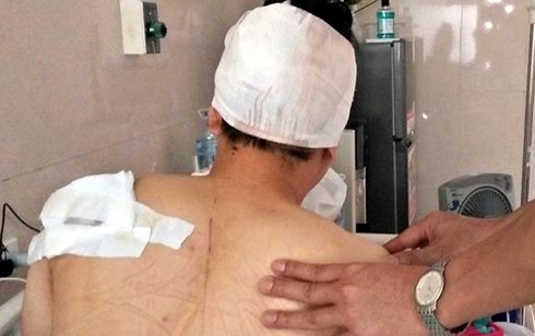 Côn đồ ngang nhiên vào chung cư Mandarin Garden chém người - ảnh 1