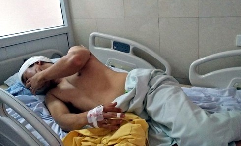 Côn đồ ngang nhiên vào chung cư Mandarin Garden chém người - ảnh 2