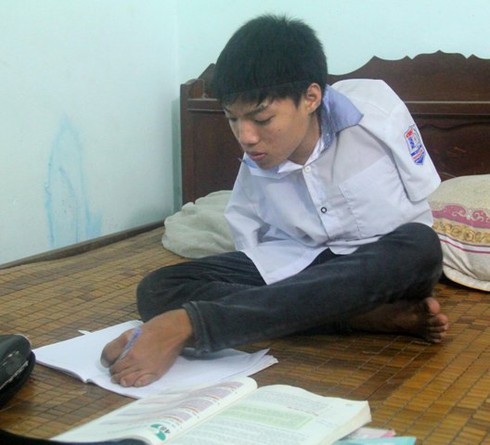 Cậu bé “chim cánh cụt” thực hiện giấc mơ tới giảng đường đại học - ảnh 1