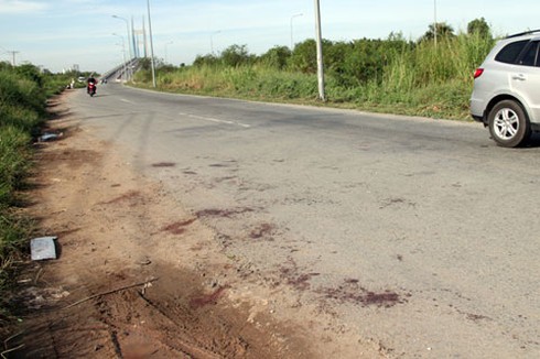 Cần nghiêm trị những kẻ chém đứt lìa tay cô gái đi xe SH để cướp tài sản - ảnh 2