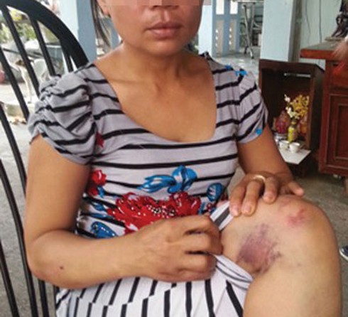 Đánh vợ tàn nhẫn vẫn cho là chuyện nhỏ - ảnh 1